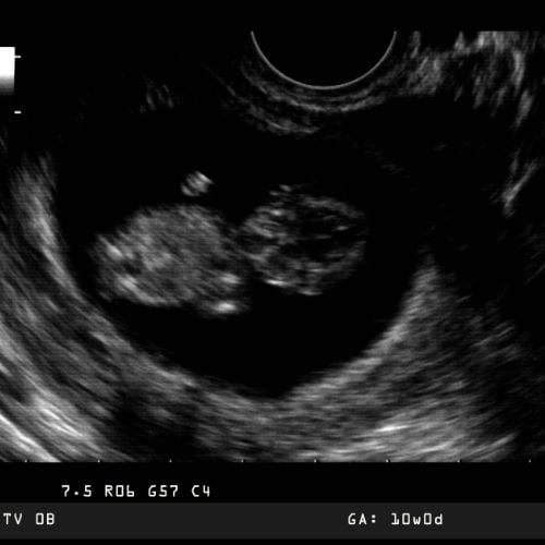 Fetal Development Milestones 1-10 weeks