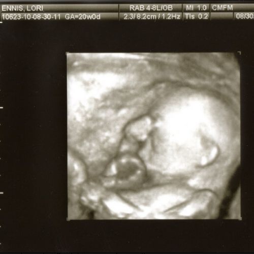 20 week fetal development